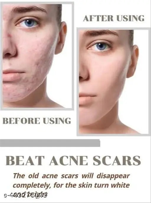 Anti-Ageing Niacid Face Serum (Pack of 2)