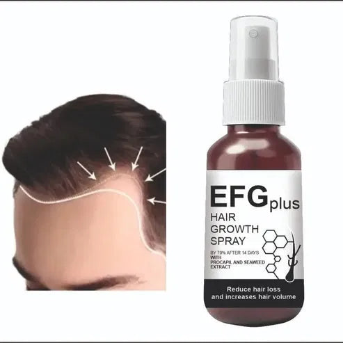 RevitaRoot Hair Growth Spray (Pack of 2)