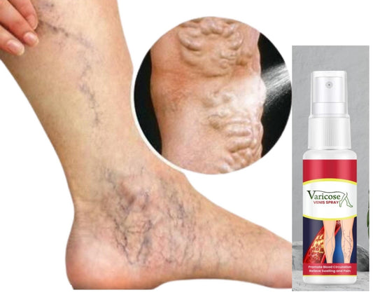 Varicose Vein Care Spray (Pack of 2)